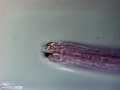 Nematoda