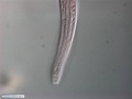 Nematoda