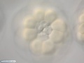 Micrômeros no embrião de bolacha-do-mar de 32 células