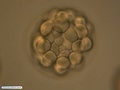Embrião de bolacha-do-mar durante a sexta clivagem