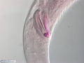 Nematoda