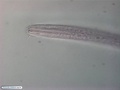 Nematoda