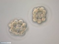 Embriões de bolacha-do-mar com 32 células