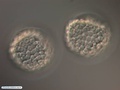Embriões de bolacha-do-mar durante blastulação
