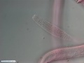 Nematoda